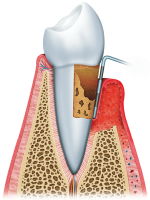 La boca - Clínica Dental Prodental Híades